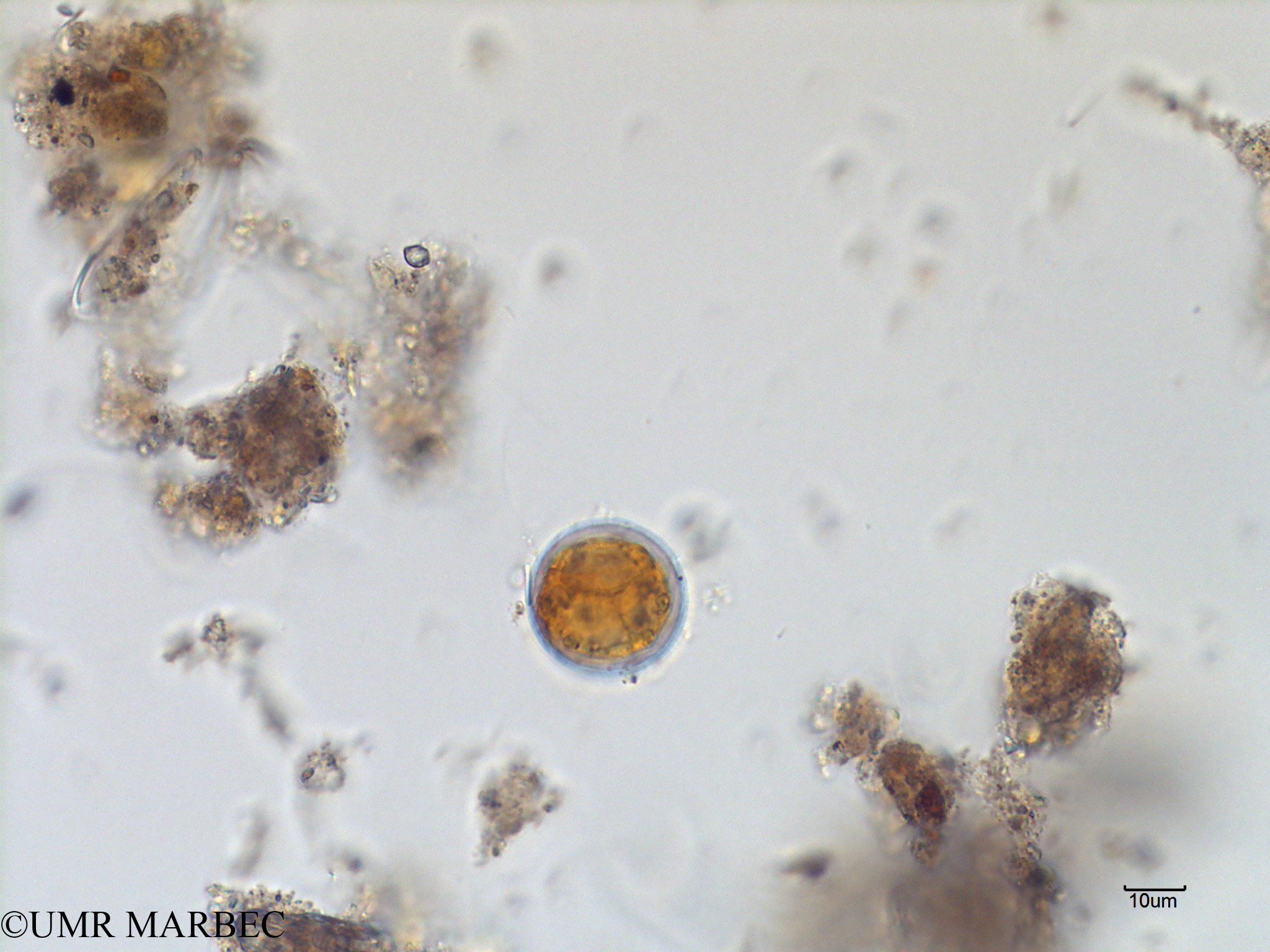 phyto/Scattered_Islands/mayotte_lagoon/SIREME May 2016/Protoperidinium sp42 (MAY4_proto lequel c-7).tif(copy).jpg